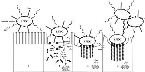 epec infektion